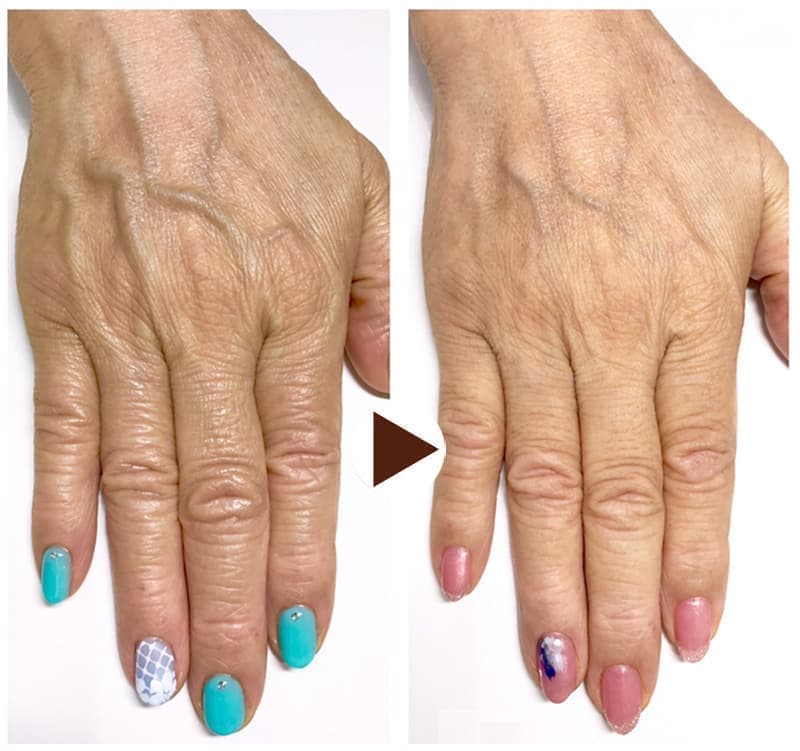 ぽぽりっしゅハンドエステ